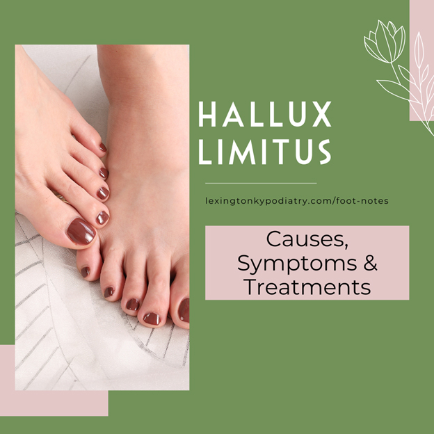 Hallux Limitus Symptoms Causes And Treatments Hallux Limitus